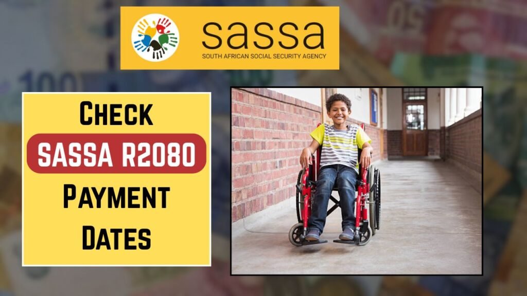 SASSA’s R2,080 Care Dependency Grant